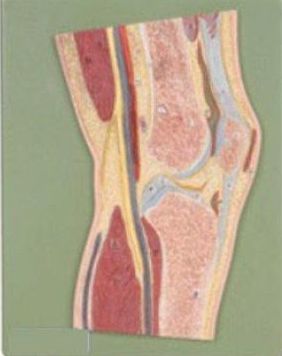 康人 髖關節(jié)剖面模型 KAR/11205
