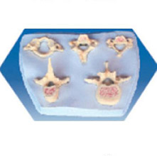  寰、樞、頸、胸、腰椎模型KAR/11137  