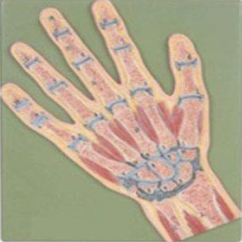 手關(guān)節(jié)剖面模型KAR/11204