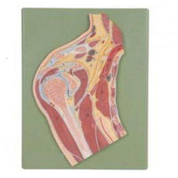 肩關(guān)節(jié)剖面模型KAR/11202