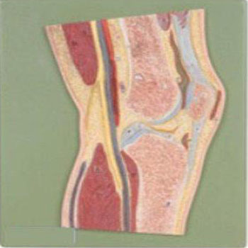  髖關節(jié)剖面模型KAR/11205  