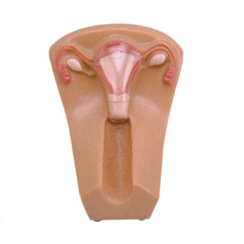 女性宮內(nèi)避孕器及訓(xùn)練模型KAR/B3