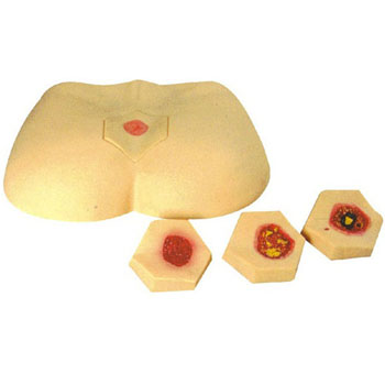 階段褥瘡護(hù)理模型KAR/10B