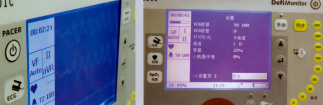 德國 普美康 XD系列 除顫監(jiān)護儀