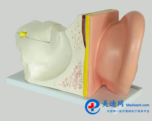 益聯(lián) 耳結(jié)構(gòu)放大模型 YLM2090 益聯(lián) 耳結(jié)構(gòu)放大模型 YLM2090