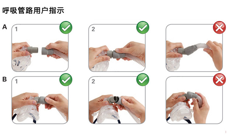 瑞思邁呼吸機(jī)VPAP IV ST 全自動(dòng)雙水平 有效治療慢阻肺/肺心病/呼吸功能不全