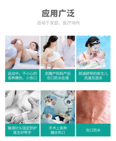 透明敷料價格 留置針敷貼 Tegaderm 透明敷料價格 留置針敷貼 Tegaderm